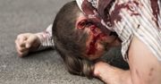 Terroryzm i jego aspekty medyczne
