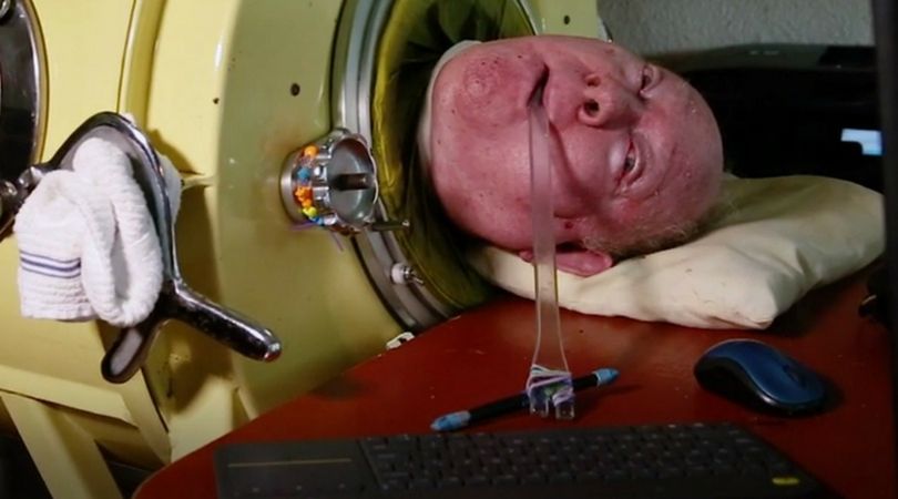 Paul Alexander pisze oraz korzysta z komputera dzięki długopisowi trzymanemu w ustach