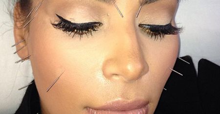 Kardashian z igłami w twarzy! (FOTO)