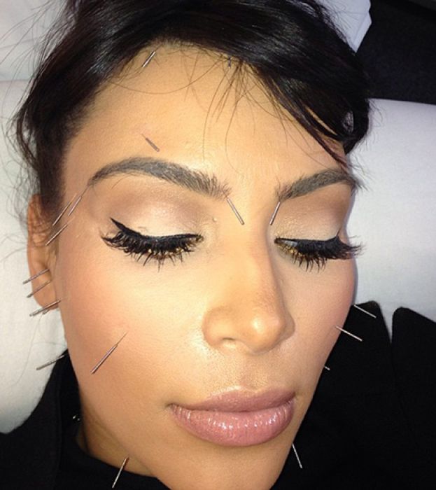 Kardashian z igłami w twarzy! (FOTO)