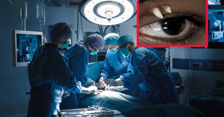 16-latkowi wyrastał ząb z oka. Pierwszy taki przypadek na świecie