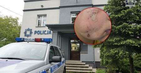 Pies rzucił się na dziecko. Jego właściciel usłyszał zarzuty