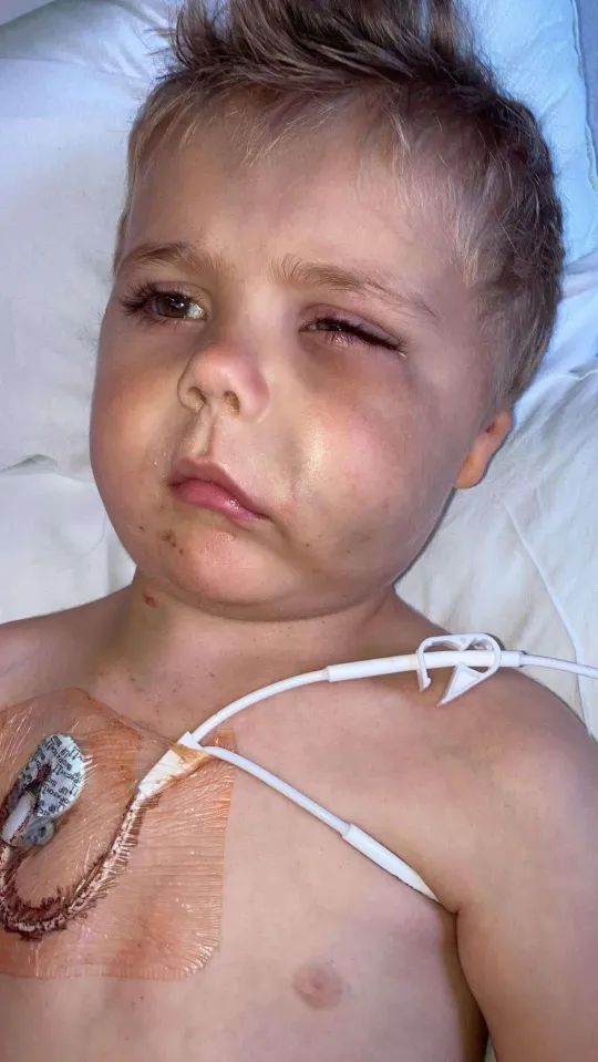 Hugo chorował na ostrą białaczkę szpikową