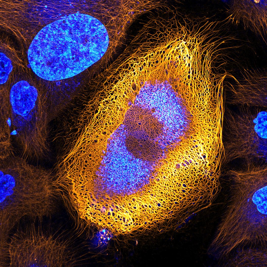 Komórki skóry ludzkiej wykazujące fluorescencję keratyną / Powiększenie 40x