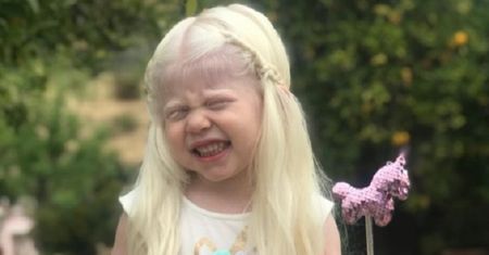 Tatiana Garcia jest albinoską. Dziewczynka podbija Instagram