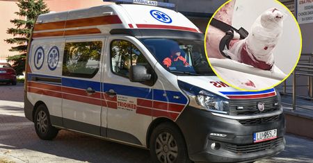To mogło zdarzyć się każdemu. Horror podczas przyrządzania kolacji