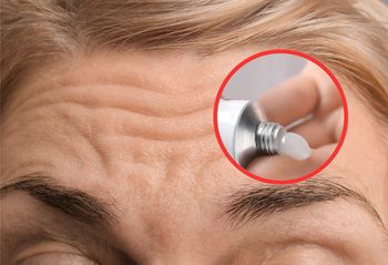 Apteczna maść za grosze. Stosuj regularnie, a zmarszczki znikną