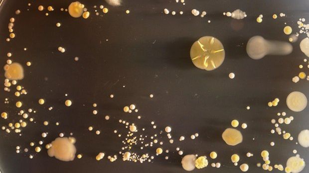 W skrócie: LG Optimus G Pro na wideo, Xperia Z zrootowana, jak wyglądają bakterie na twoim smartfonie 1