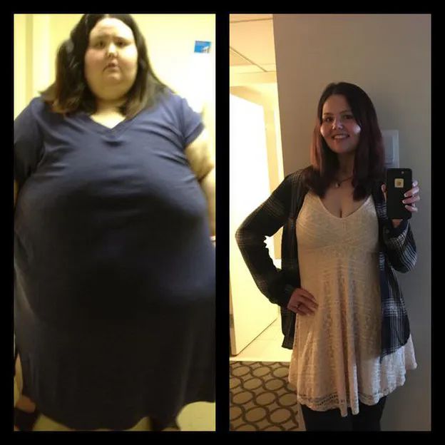 Christina Phillips in before and after photos