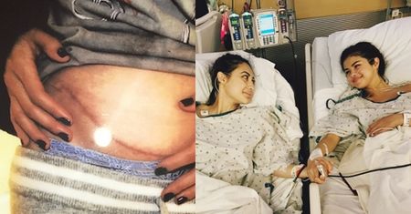 Selena Gomez MIAŁA PRZESZCZEP NERKI! "Poszukiwania dawcy trwały MIESIĄCAMI!"