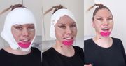 Julia von Stein zdjęła opatrunek po operacji. Fani OSTRO komentują jej decyzję [WIDEO]