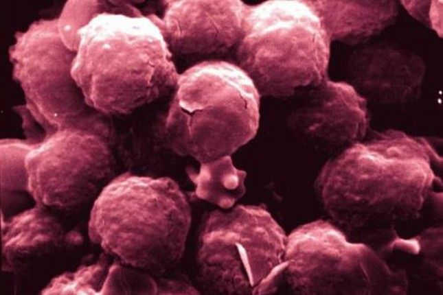 Klonowanie embrionów zapewni dostęp do komórek macierzystych