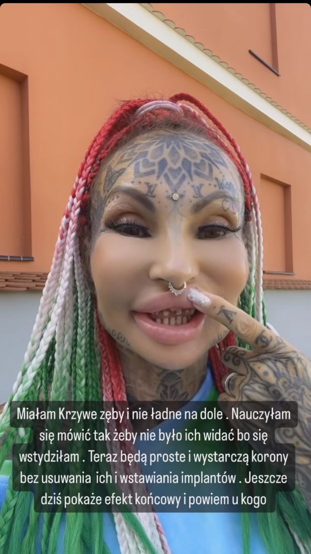"Królowe życia". Adrianna Eisenbach SPIŁOWAŁA ZĘBY. Do twarzy jej z takimi igiełkami? (WIDEO)