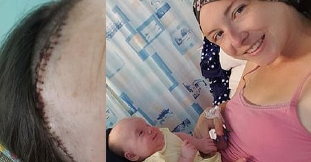 Myślała, że głowa boli ją przez ciążę. Badania wykryły guza mózgu