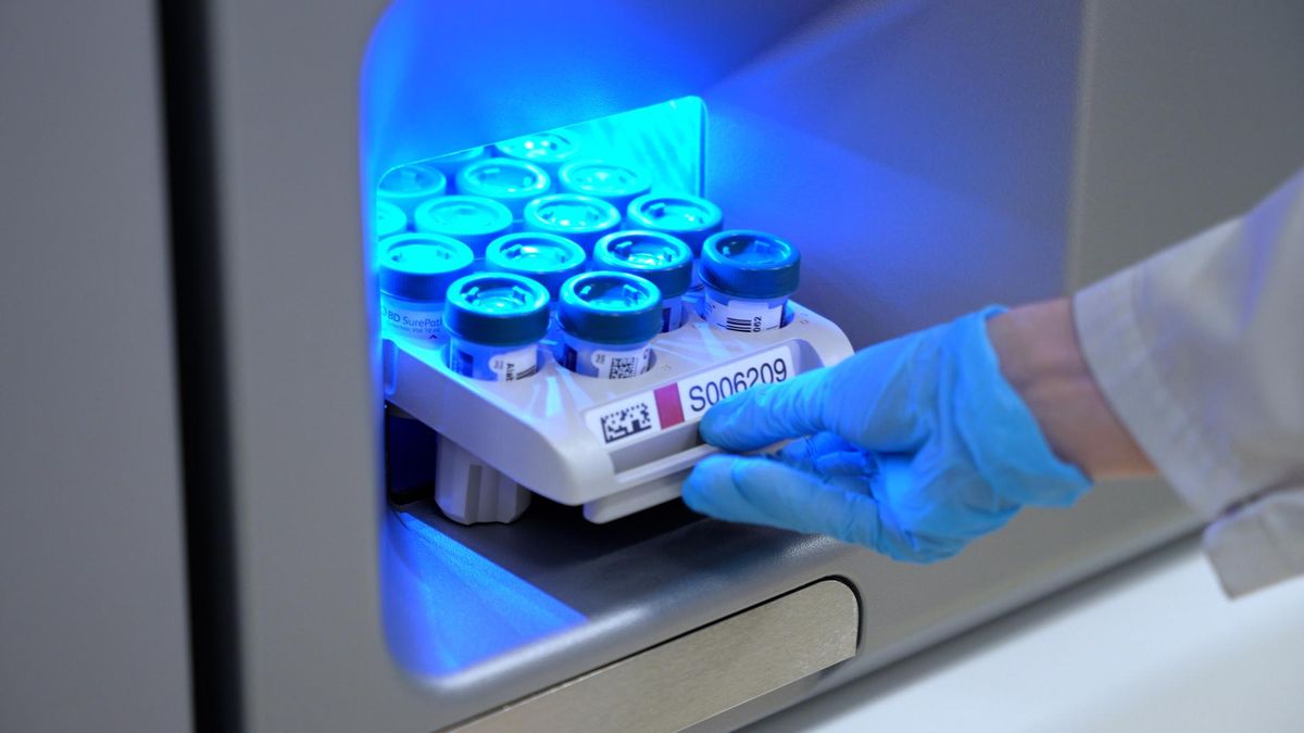 HPV pod pełną kontrolą. ALAB laboratoria wdraża rozszerzone genotypowanie wirusa