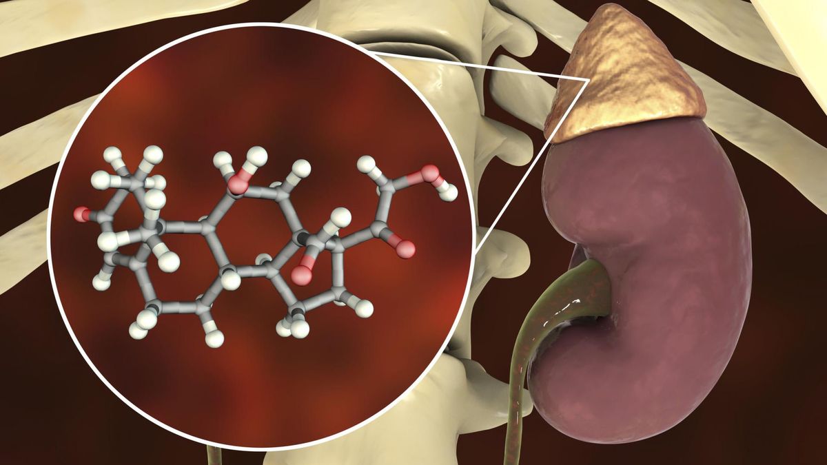 Hiperaldosteronizm to nadczynność kory nadnerczy, która prowadzi do miażdżycy i niewydolności nerek.