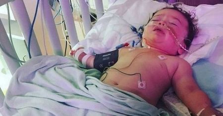 Niemowlę dziwnie przewracało oczami. Okazało się, że ma w mózgu guza wielkości cytryny