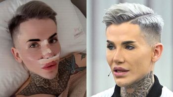 Polski "żywy Ken" wykorzystał fragment żebra, by zrobić sobie nowy nos. Fajnie? (FOTO)