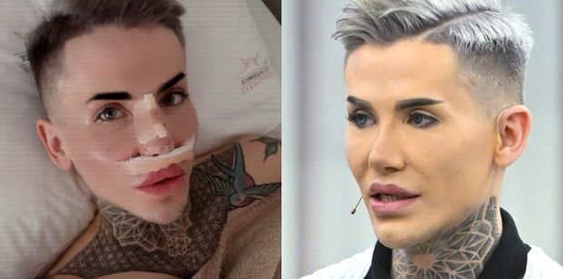 Polski "żywy Ken" wykorzystał fragment żebra, by zrobić sobie nowy nos. Fajnie? (FOTO)