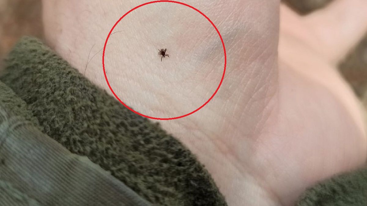 Uważajcie na kleszcze!