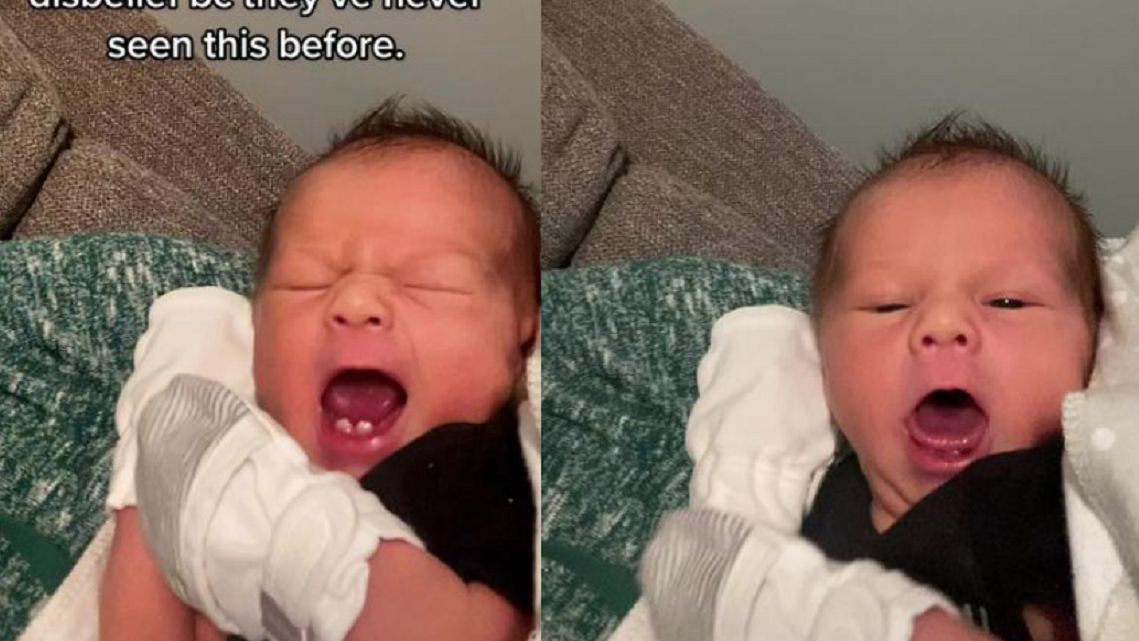 Dziecko urodziło się z zębami.