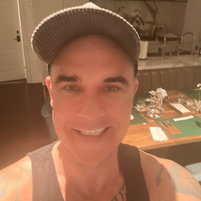 Robbie Williams unveiled new teeth