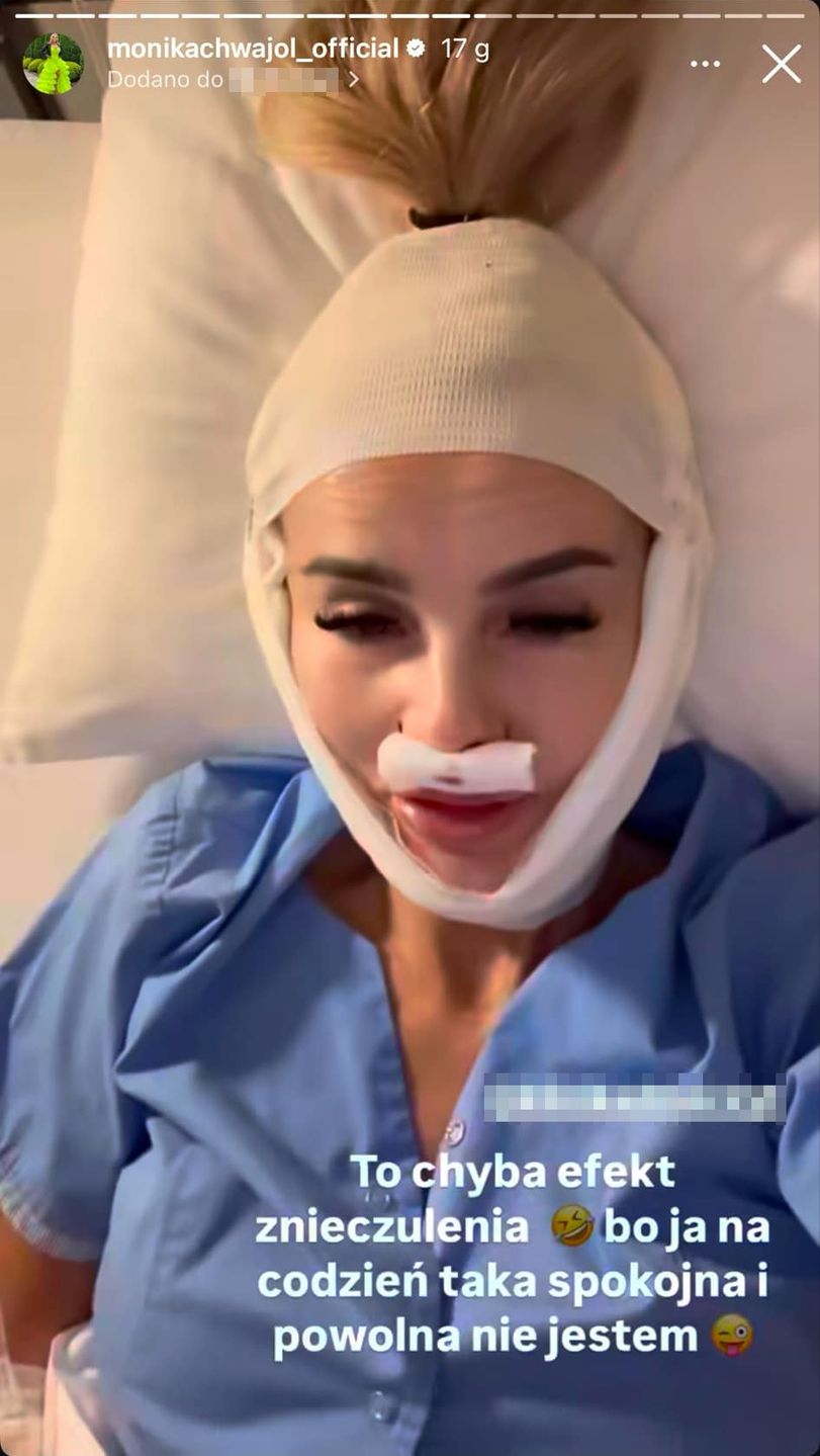 Monika Chwajoł zrobiła sobie lifting i lip lift