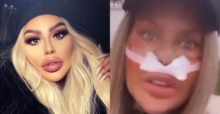 Laluna Unique z "Królowych Życia" pokazuje, jak wyglądała przed TURECKIMI OPERACJAMI (FOTO)