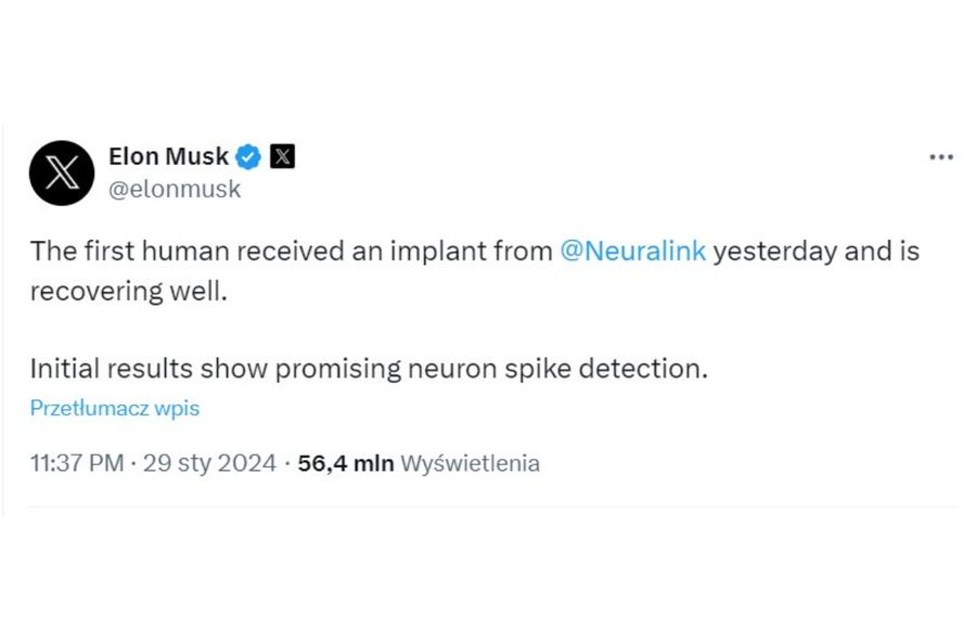 Elon Musk o pacjencie z implantem w móżgu