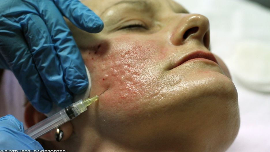 Niefachowo wykonane zabiegi medycyny estetycznej mogą być zagrożeniem