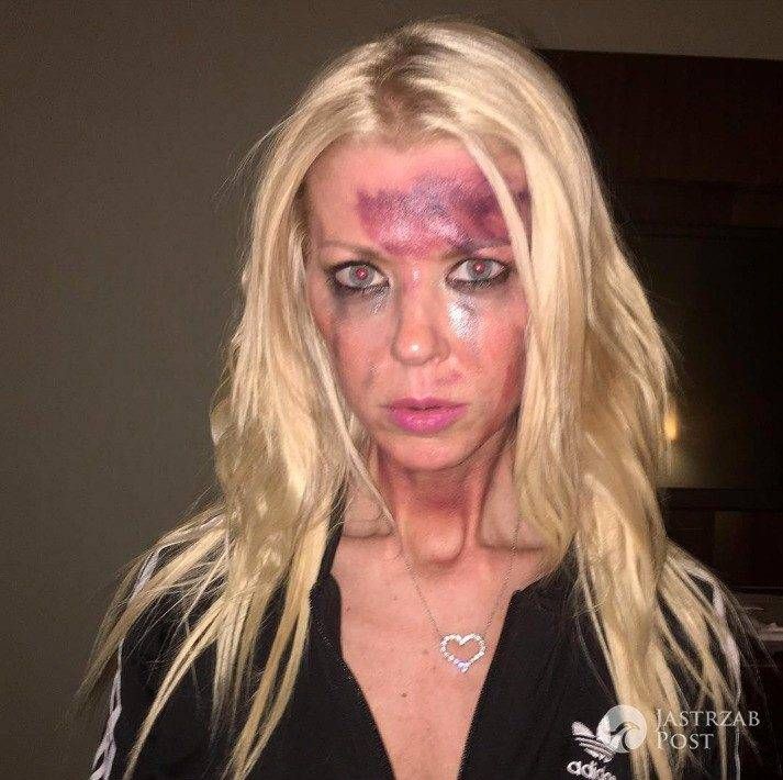 Tara Reid pobita