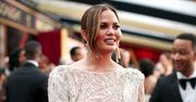 "Tylko moje policzki są naturalne" Chrissy Teigen przyznaje się do operacji plastycznych!