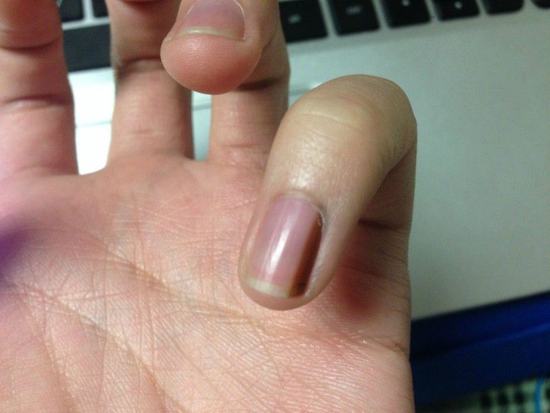 Witamina D i wapń zawarte w jajkach zapobiegają osteoporozie. Zawarte w nich aminokwasy sprawiają, że paznokcie i włosy są zdrowe.