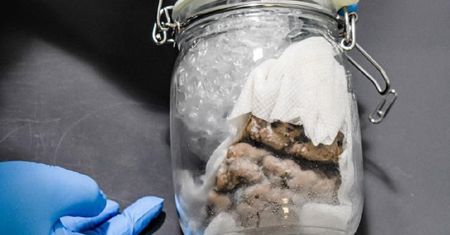 Kanada. Celnicy znaleźli na granicy ludzki mózg. Ktoś wysłał go pocztą