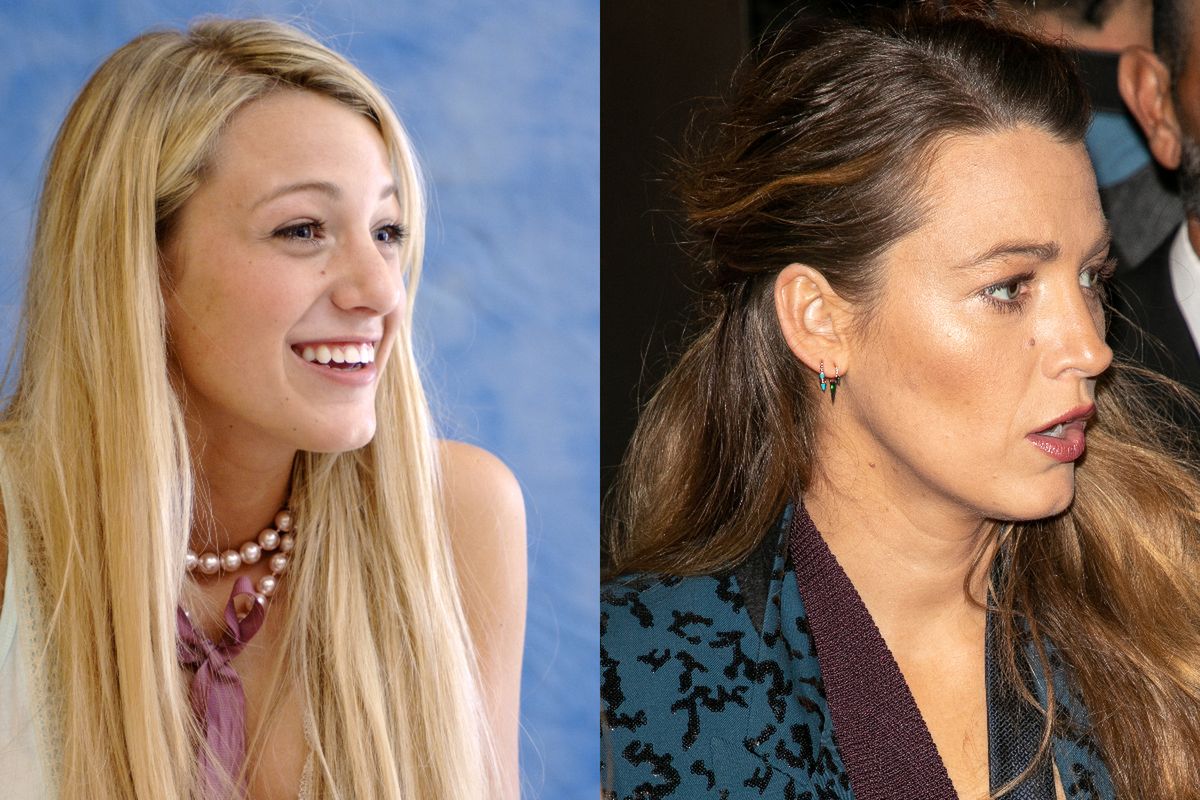 Blake Lively przed operacją nosa i po niej 