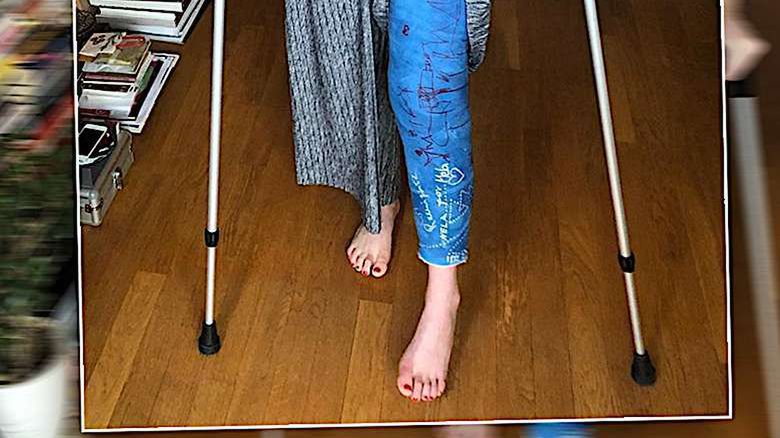 Mela Koteluk złamała nogę