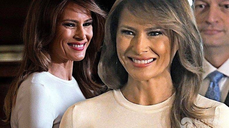 Melania Trump powiększyła piersi