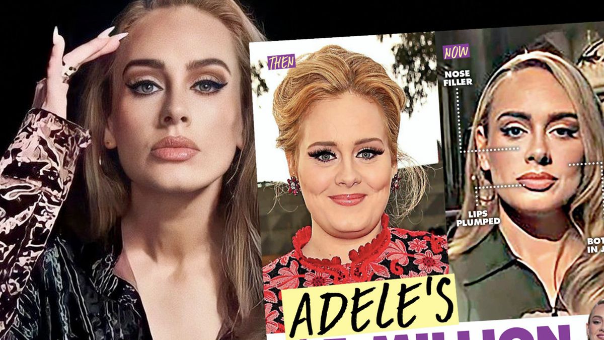 Operacje plastyczne Adele na celowniku tabloidu. Co sobie zmieniła i ile wydała? Ocenia ekspert