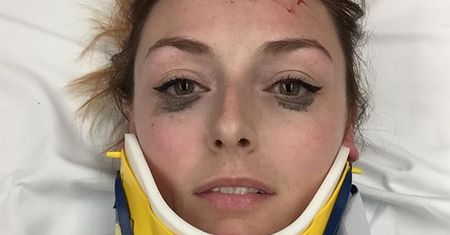 O jej selfie po wypadku mówią wszyscy. Przez jeden szczegół