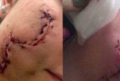 Napastnik, który okaleczył butelką dwie dziewczyny, ma zarzut usiłowania zabójstwa