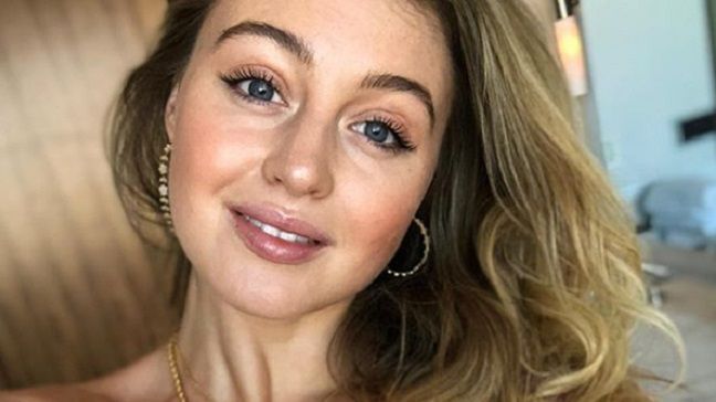Trudno uwierzyć w to, że modelka, która dziś może się pochwalić 4 milionami obserwatorów na Instagramie, miała jakiekolwiek kompleksy związane z wyglądem.
