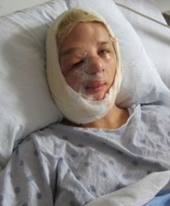 "Dziewczyna z połową twarzy".  Żaden lekarz nie chciał jej pomóc. Aż nagrała filmik