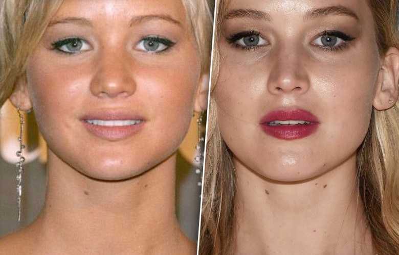 Jennifer Lawrence miała operację plastyczną nosa? Zdjęcia przed i po