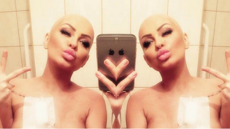 Ania Szubert i jej życie po raku