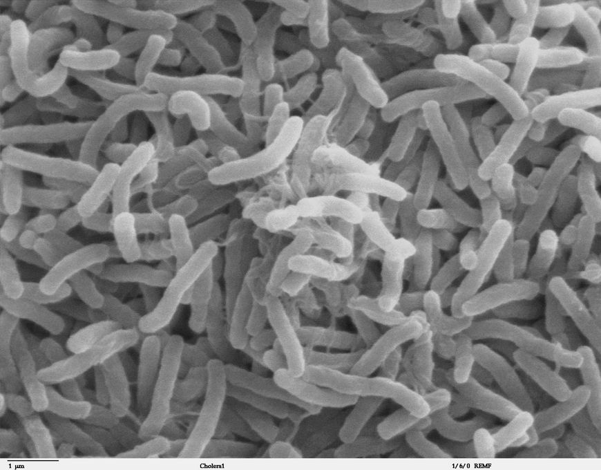 Mikroskopowy obraz bakterii cholery 