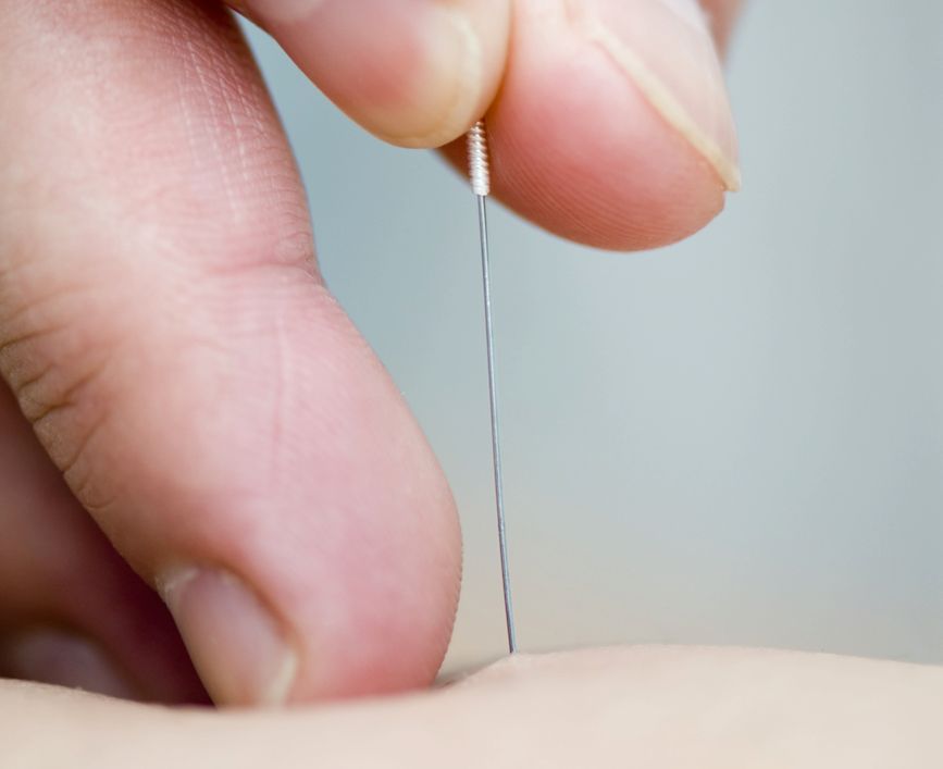 Akupunktura - galeria