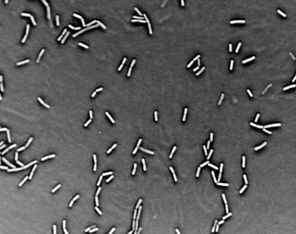 W Twojej klawiaturze może być 10 milionów bakterii