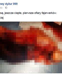 Ratownik pokazał, co ratował w Sylwestra. "Robią sobie konfetti z kończyn"