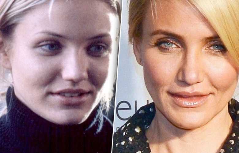 Cameron Diaz miała operację plastyczną nosa? Zdjęcia przed i po