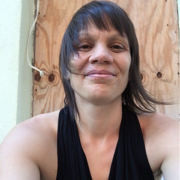 Melanie podjęła decyzję: nie będzie rekonstruować biustu. 